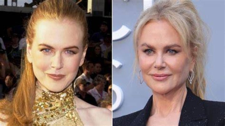 Has Nicole Kidman had a boob job? Actress shows off impressive cleavage