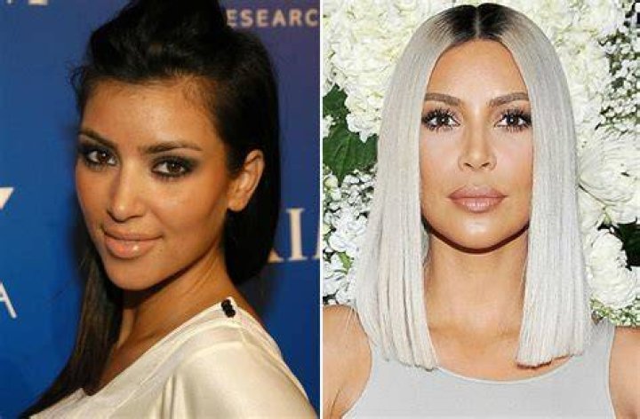 Kim Kardashian Plastic Surgery True or False? Past vs Present Photos