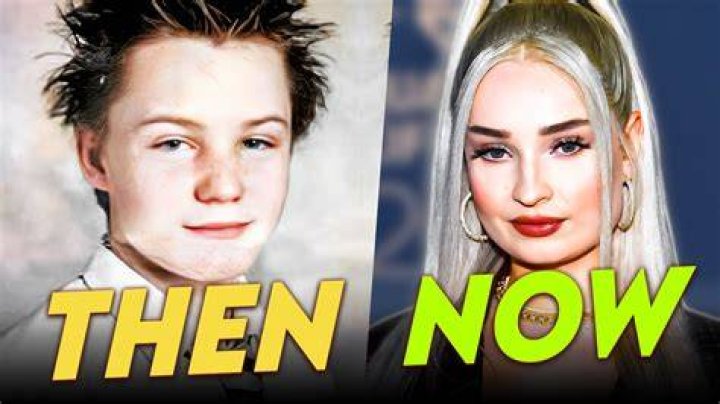 Kim Petras Before And After